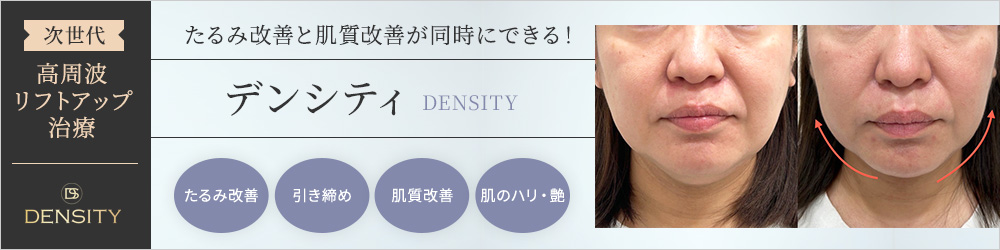 たるみ改善とか肌質改善が同時にできる高周波リフトアップ治療デンシティ