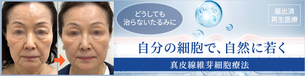 真皮線維芽細胞療法で安全に自然な若さ