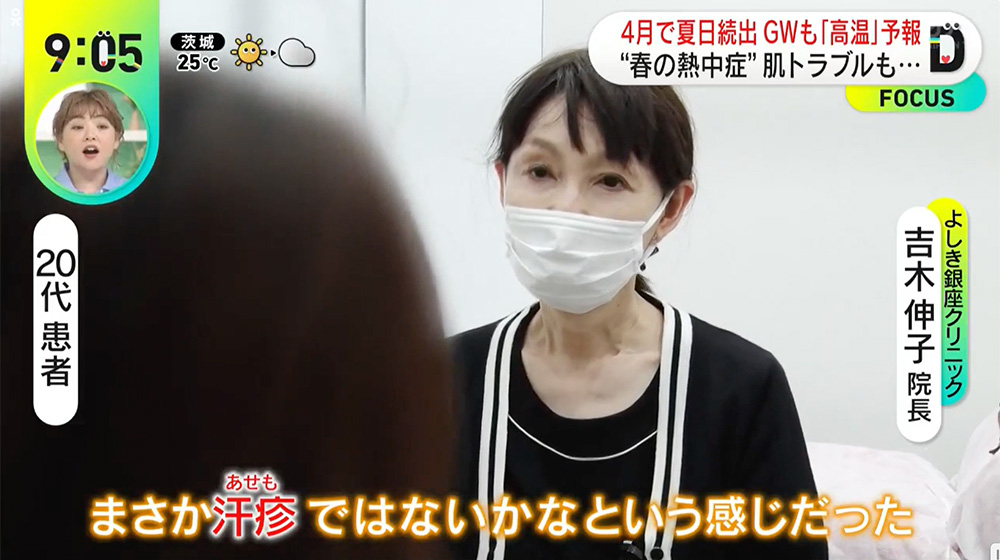 4月で夏日続出肌トラブルも