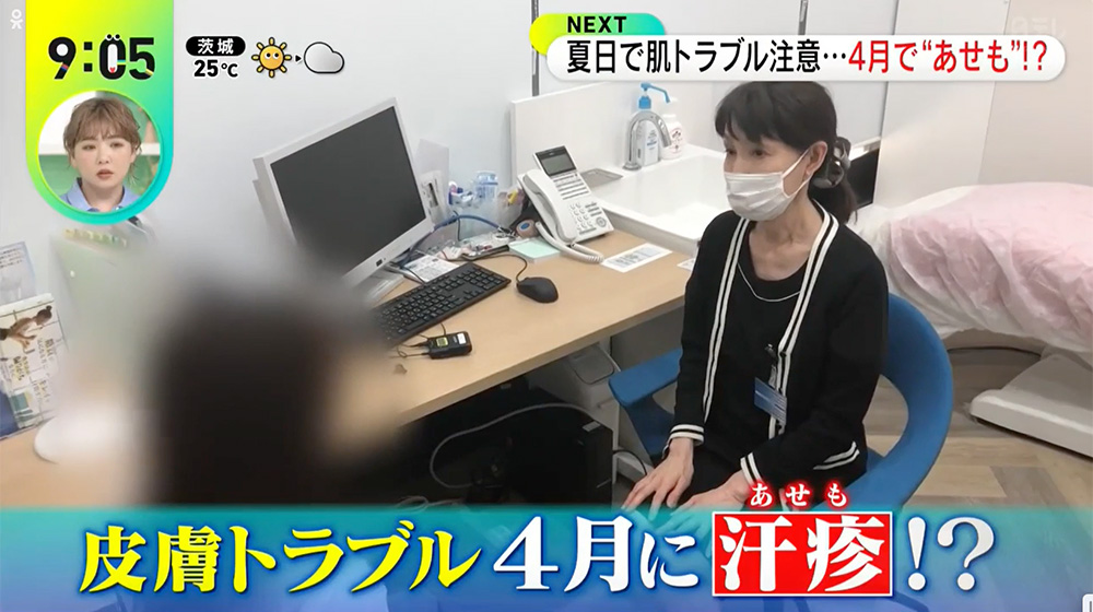 皮膚トラブル4月に汗疹！？