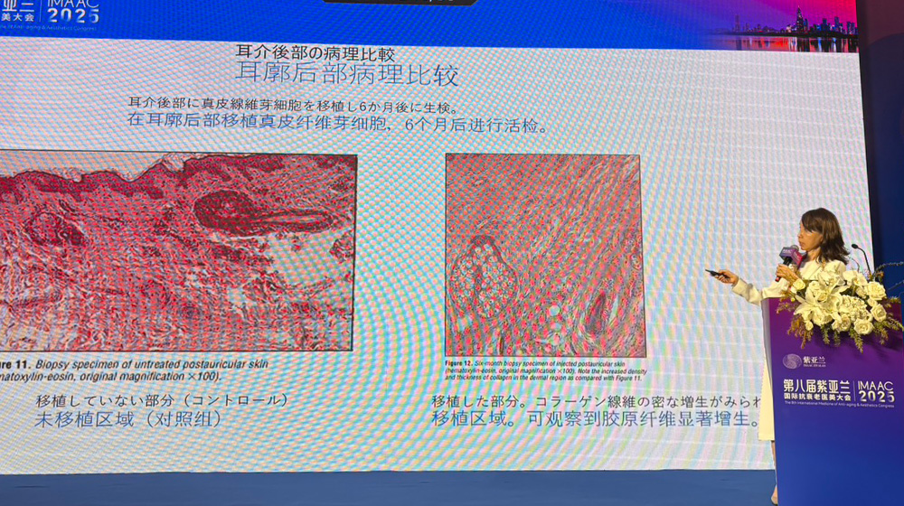 何度も洗顔して乾燥肌に