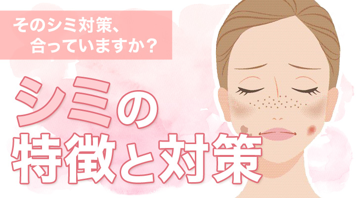 シミの特徴と対策