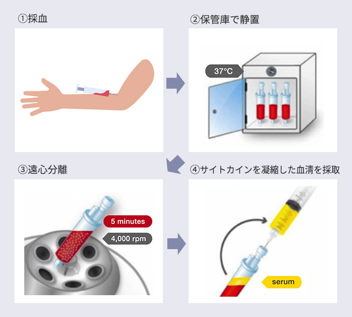 ACRS療法の治療の流れ