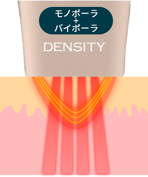 モノバイチップ