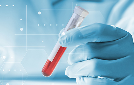 事前血液検査（感染症検査）