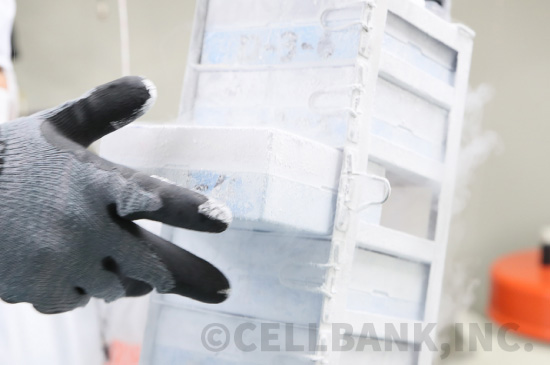 細胞を半永久的に冷血保存