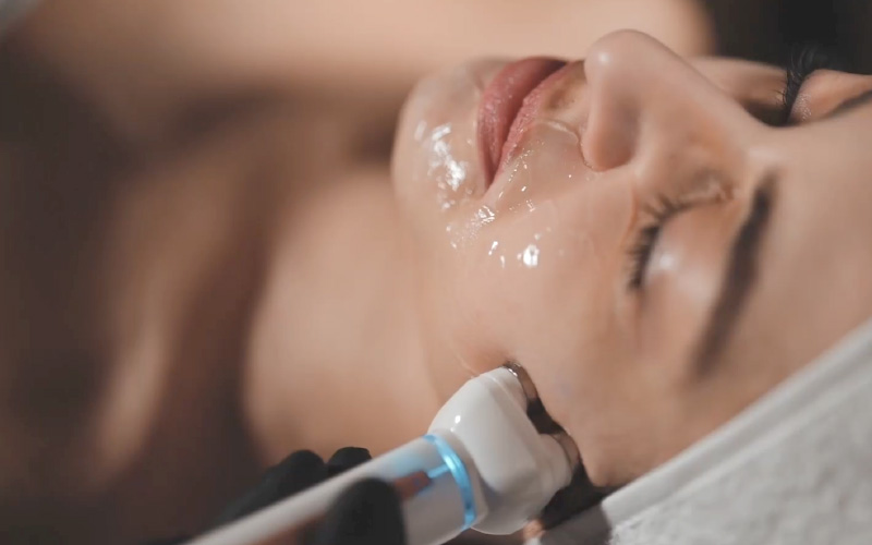 スマスアップ・ネオのイメージ写真