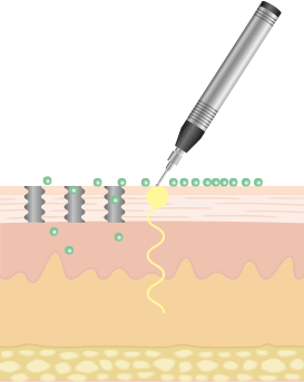 ペン型プローブ