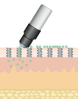 ローラー型プローブ