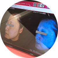 施術の説明や同意書の記入