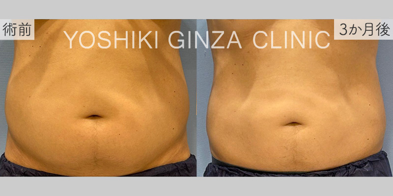 クルスカ 腹部の症例写真