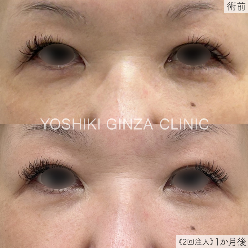 リジュランアイの症例写真