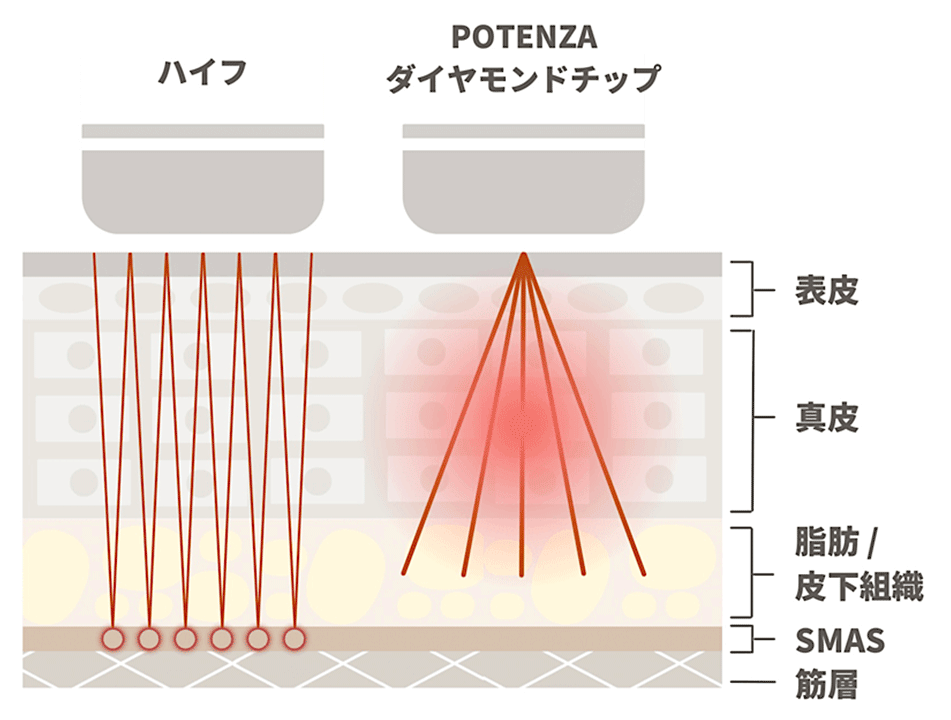 ドラッグデリバリーシステムの詳細