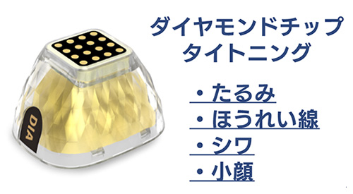 ダイヤモンドチップ タイトニング