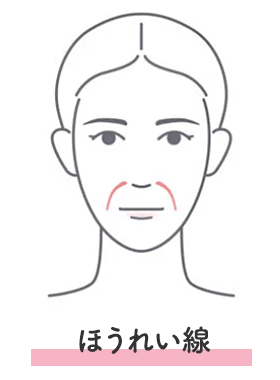 ほうれい線