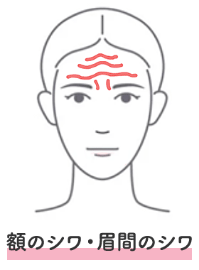 額のシワ・眉間のシワ