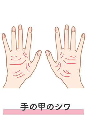 手の甲のシワ