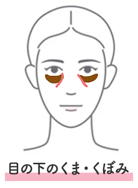 目の下のくま・くぼみ
