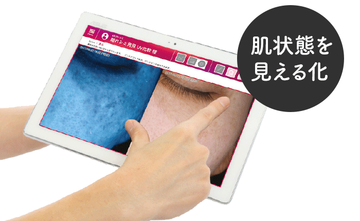 肌状態を見える化
