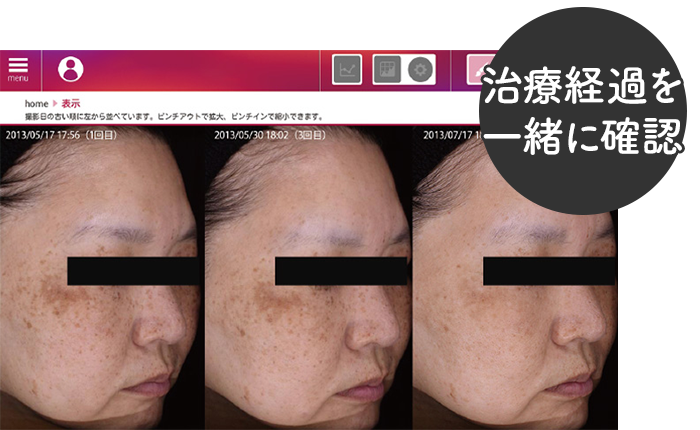 治療経過を一緒に確認