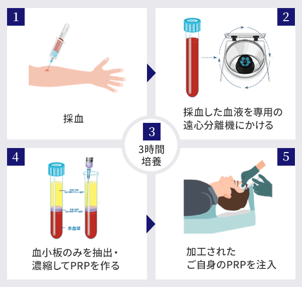 ACRS療法の治療の流れ