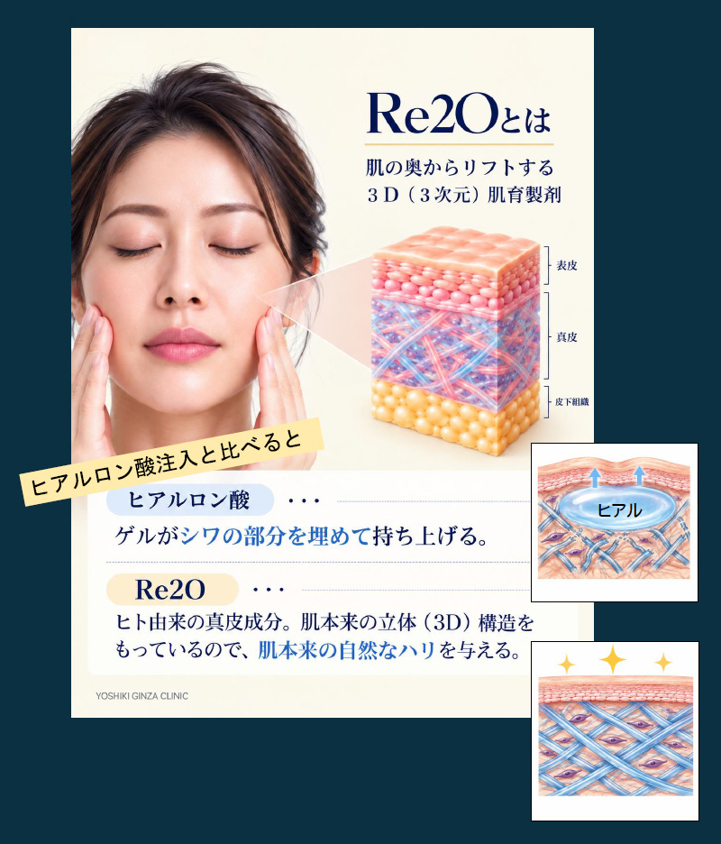 Re2O（リトゥオ）とは